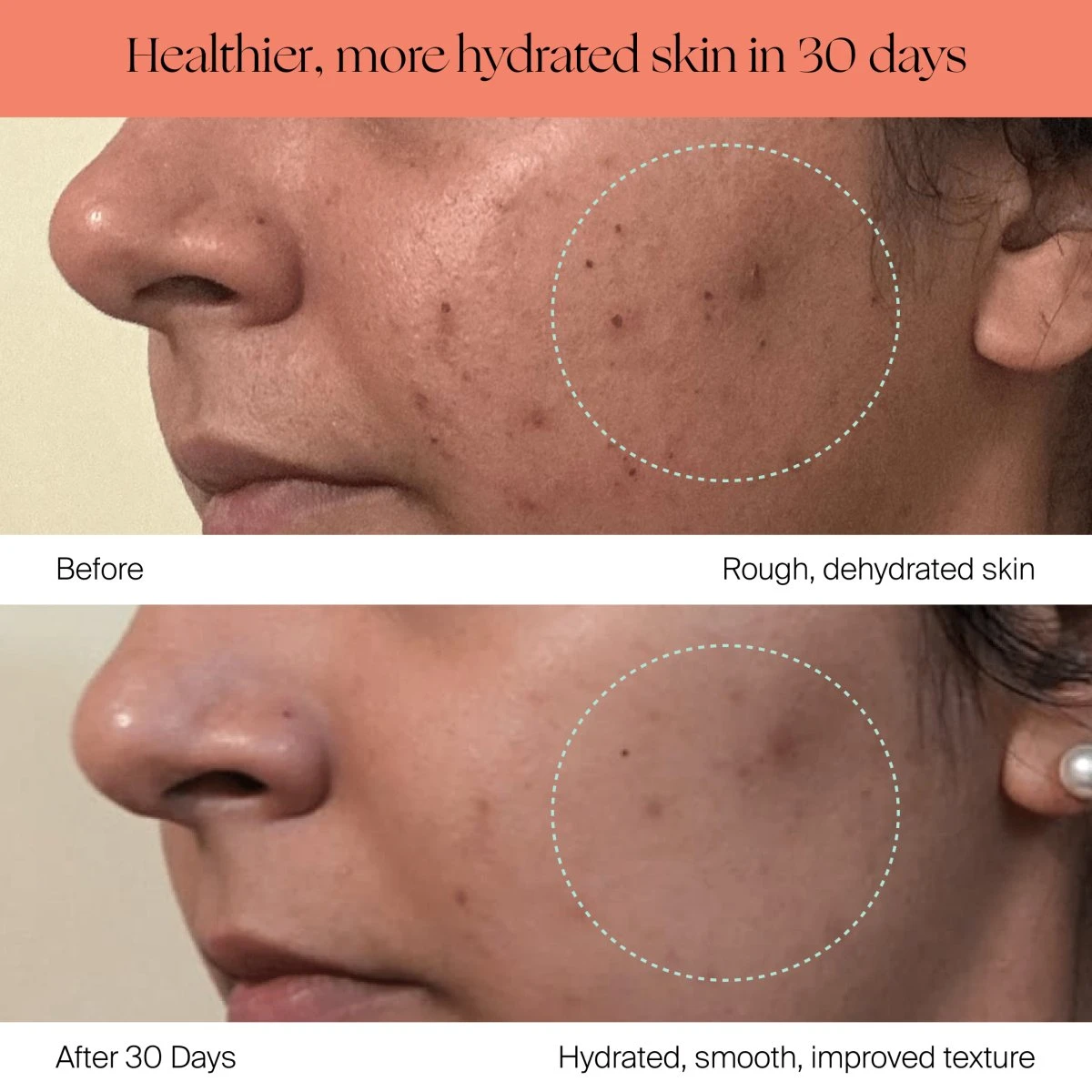 Canopy Large Room Humidifier: Hydrate Plants, Skin & Space 12 Canopy Large Room Humidifier: Hydrate Plants, Skin & Space - Image 10